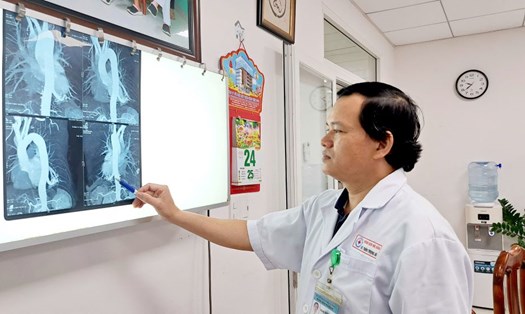 Đà Nẵng thành lập Ban Chỉ đạo thực hiện Chiến lược quốc gia phòng, chống bệnh lao. Ảnh: Bệnh viện Đà Nẵng