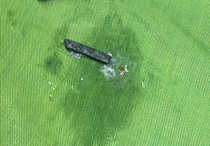 The magnet pieces were removed. Photo: BVCC