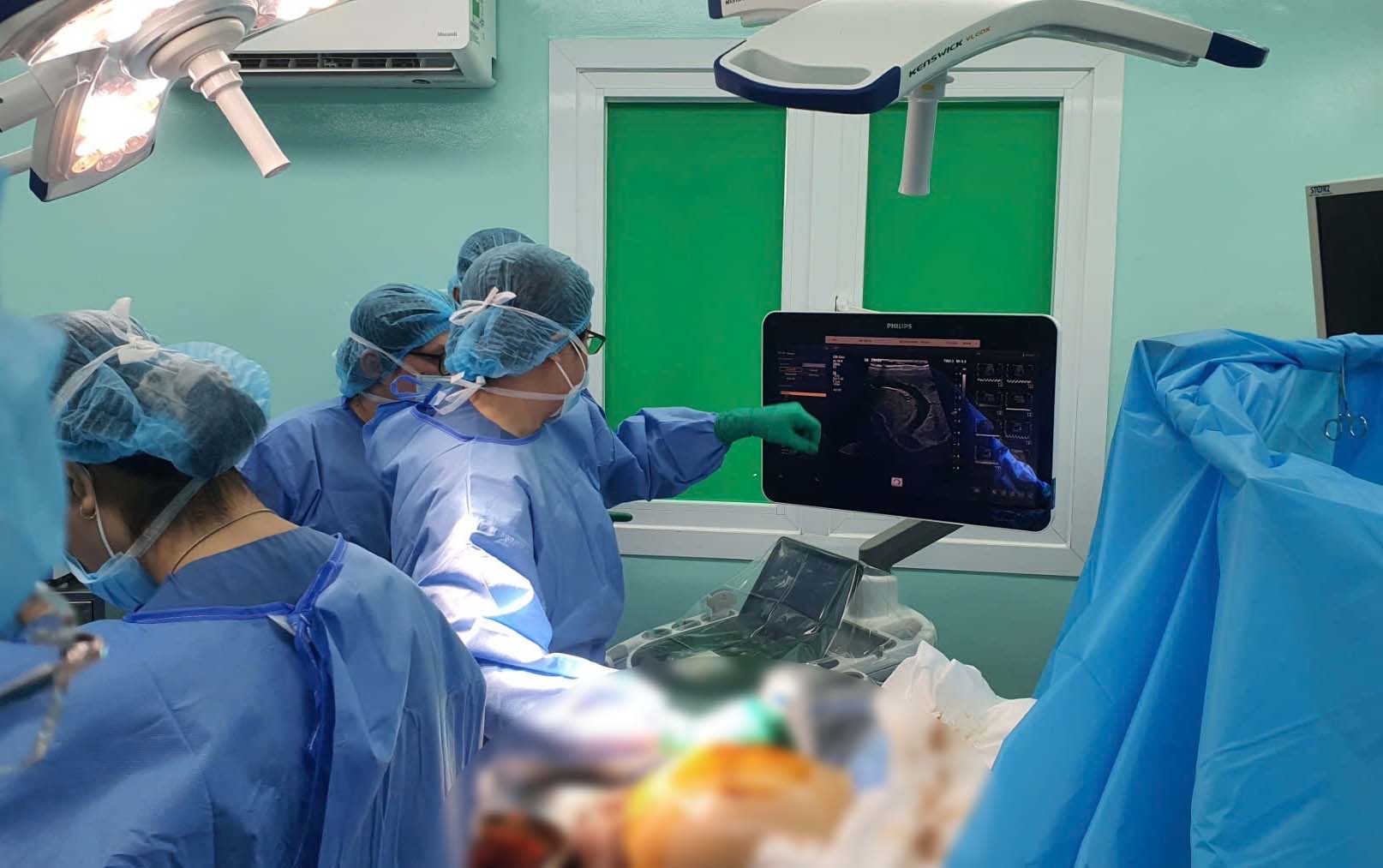 The team successfully intervened, saving the life of a fetus with a giant placental tumor. Photo: Provided by the hospital