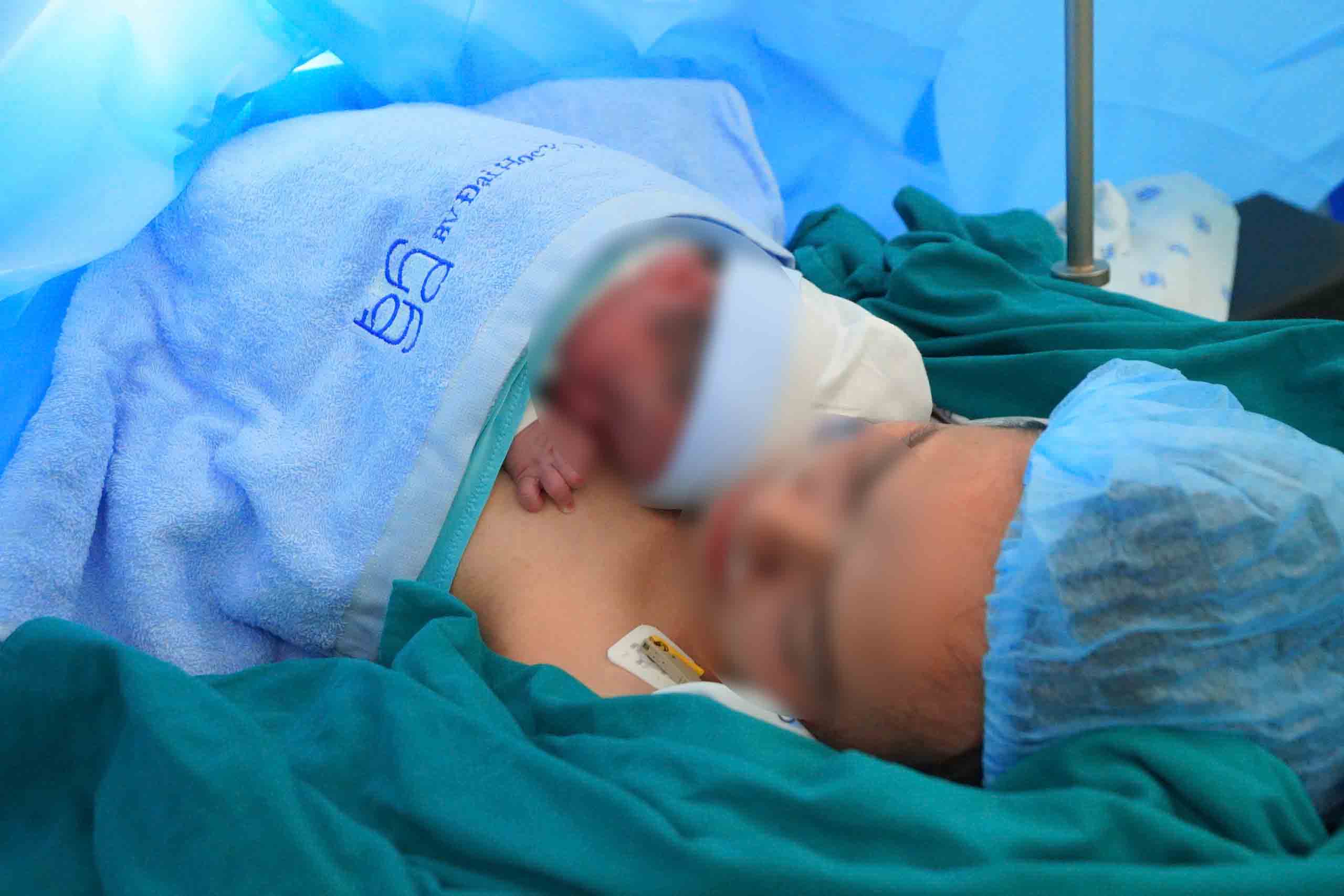 Sauvetage d'un fœtus depuis le ventre de sa mere grace a une procedure d'intervention complexe.