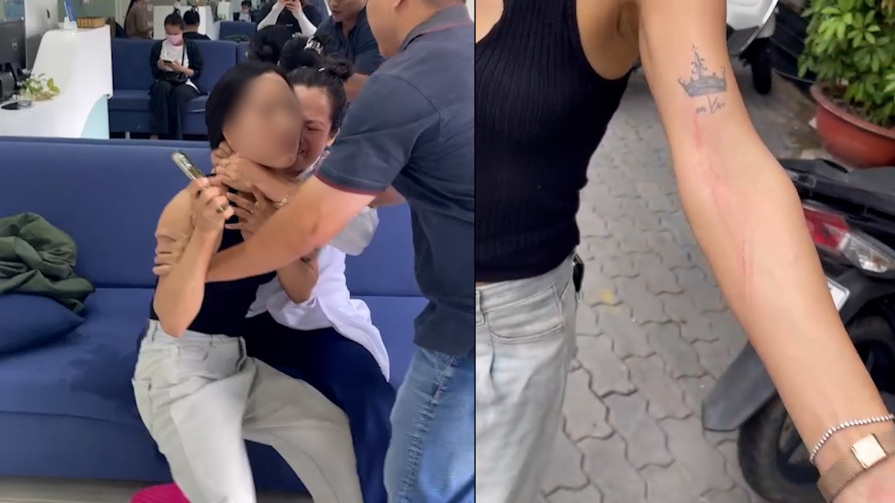 患者は、何度も体上のTuyet Chinh歯科施設の人々の影響を受けました。写真：提供されたキャラクター