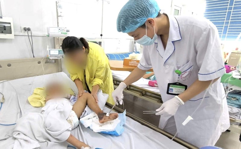 4-year-old boy in critical condition due to applying herbal medicine to treat cat scratches. Photo: Thanh Dang