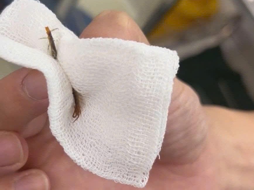 Successfully caught a live reptile in the ear canal of a 33-year-old male patient. Photo: BVCC