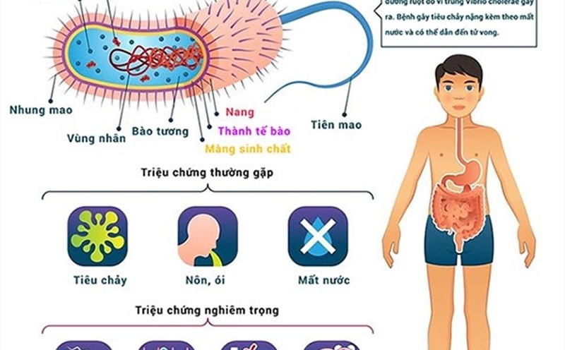 Vietnam is vigilant against cholera. Photo: VNVC