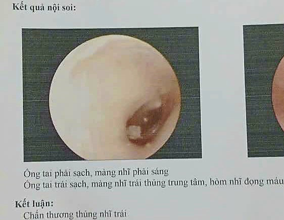 Nu sinh bi danh hoi dong o Da Nang bi chay mau mui lien tuc, tam ly bat on. Anh: Truong An