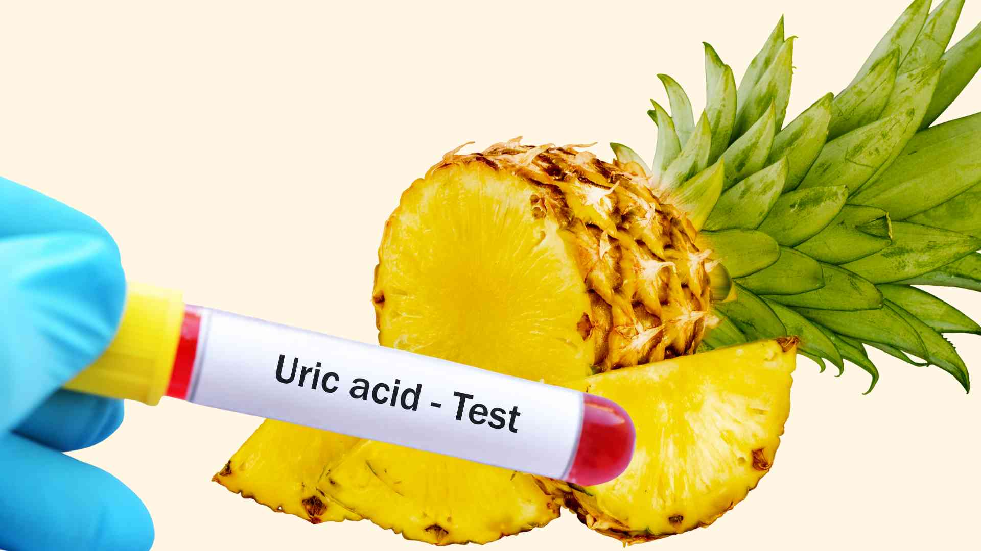 Supplementing pineapple properly can help reduce uric acid. Graphics: Ha May
