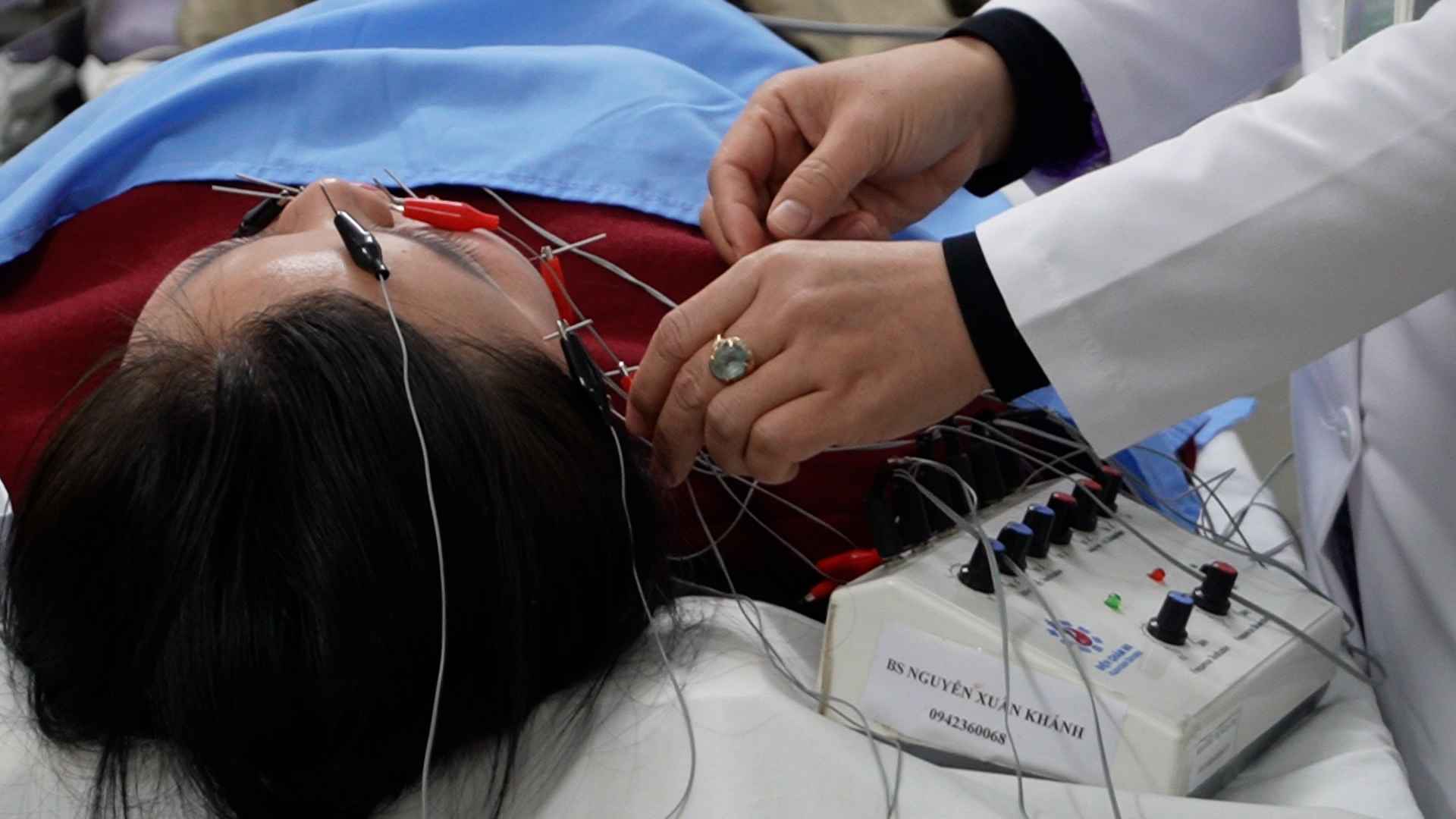 Doctors warn that bathing late, catching a cold can cause paralysis of the 7th nerve.