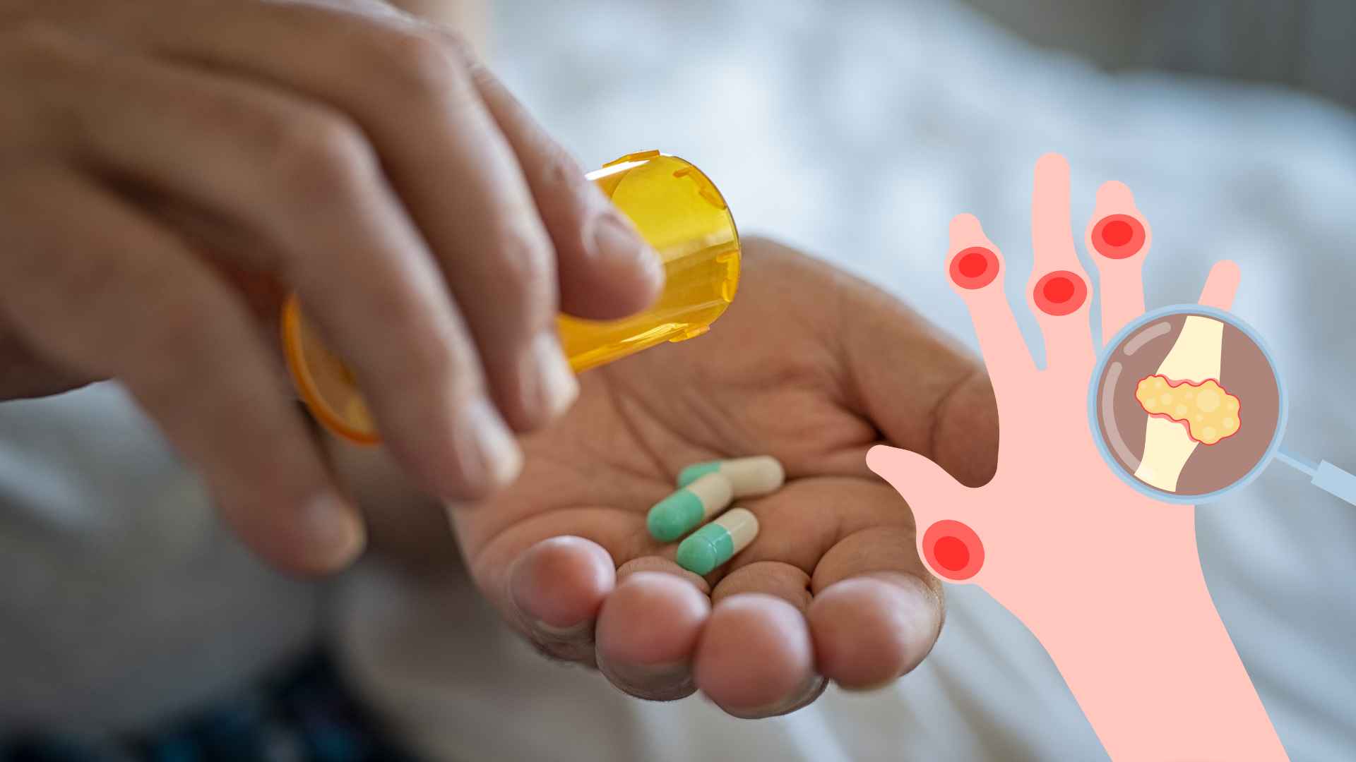 People with high uric acid when taking medicine need to have a diagnosis and instructions from a doctor. Graphic photo: Huong Son