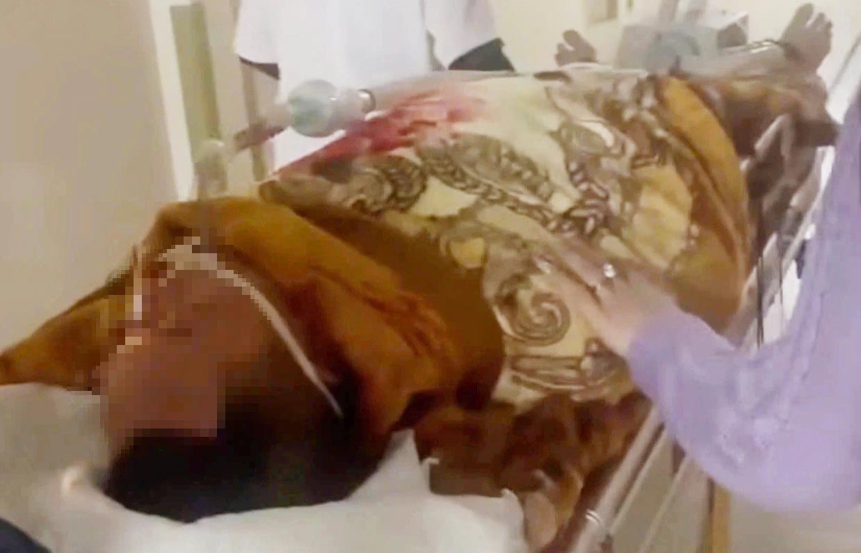 Patient H in critical condition after eating blood pudding. Photo: Hoang Anh.