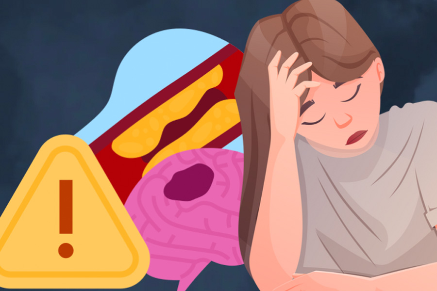 Experts warn of the risk of arterial obstruction in people without symptoms. Graphics: Thien Nhan