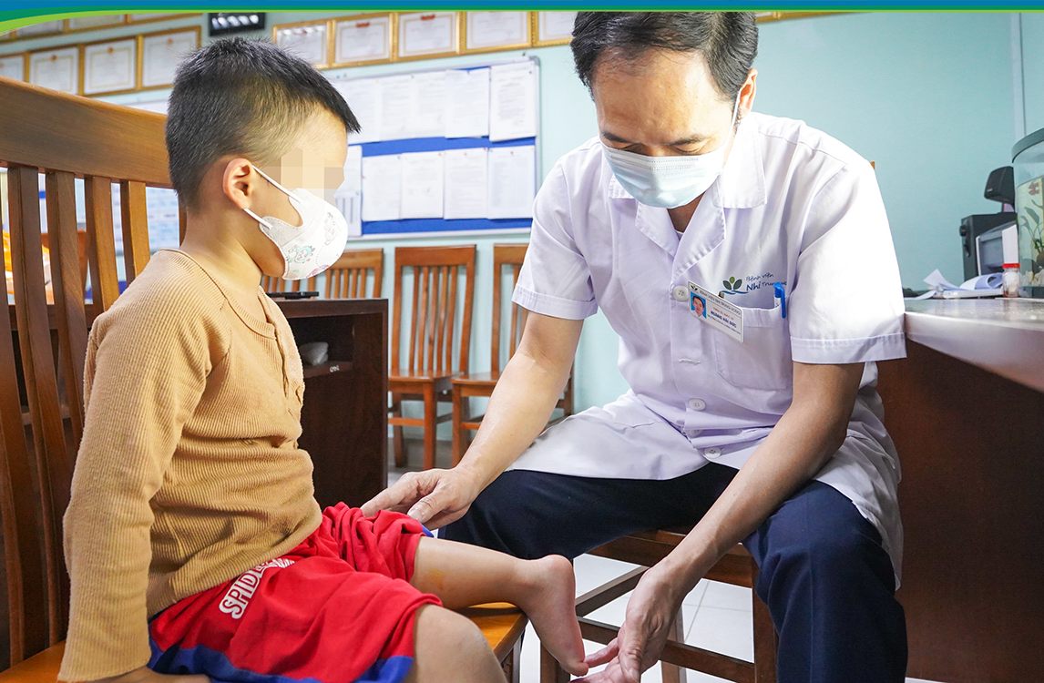 Dr. Hoang Hai Duc - Head of Orthopedics Department, National Children's Hospital - examines a child patient after a 180-degree leg rotation surgery. Photo: BVCC