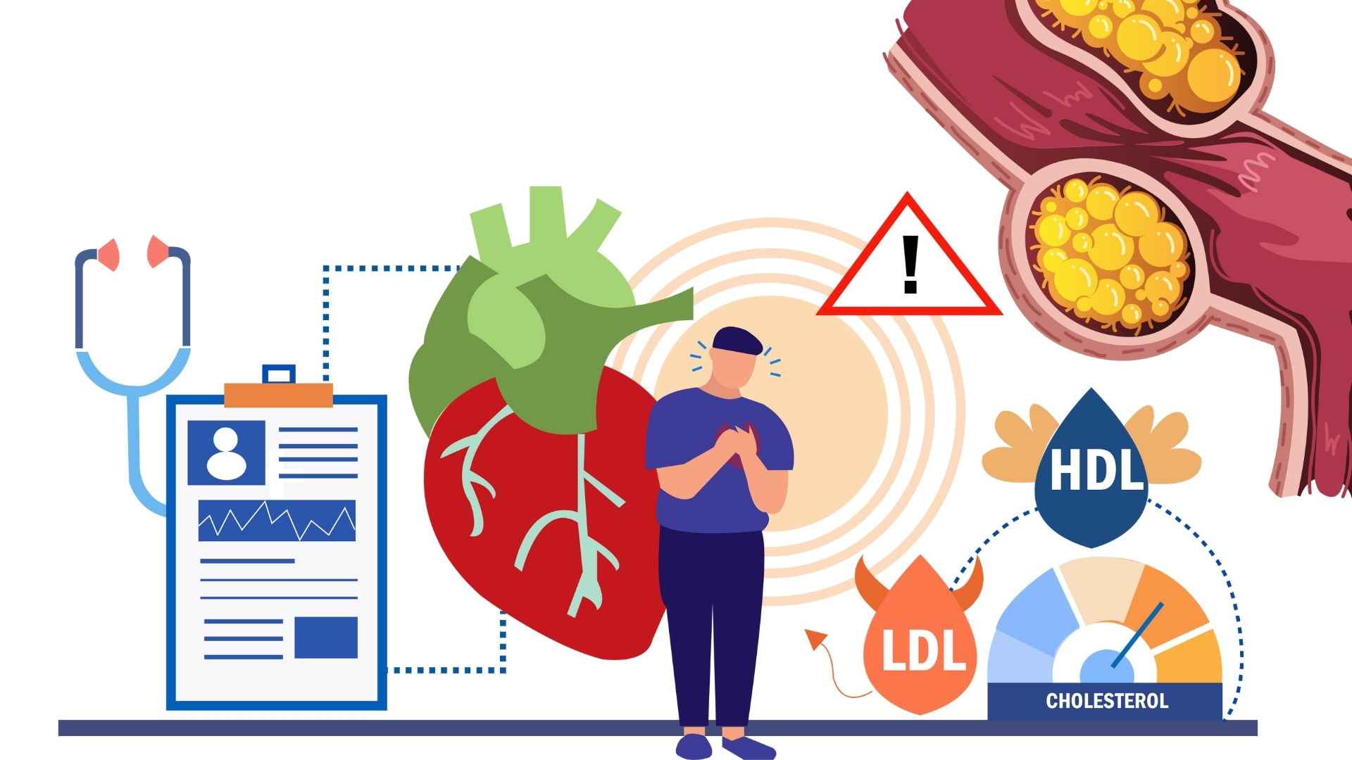 People with blood fat, if they have a proper lifestyle and diet, will help reduce this condition. Graphic photo: Huong Son