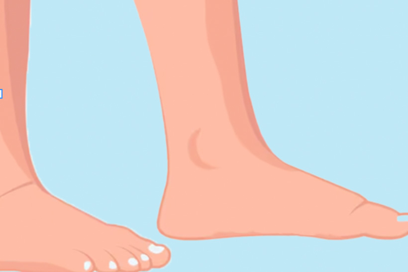 Ban chan phang khien vom chan khong nang do co the hieu qua gay dau chan, moi goi va kho duy tri kha nang di bo trong thoi gian dai. Do hoa: Thien Nhan