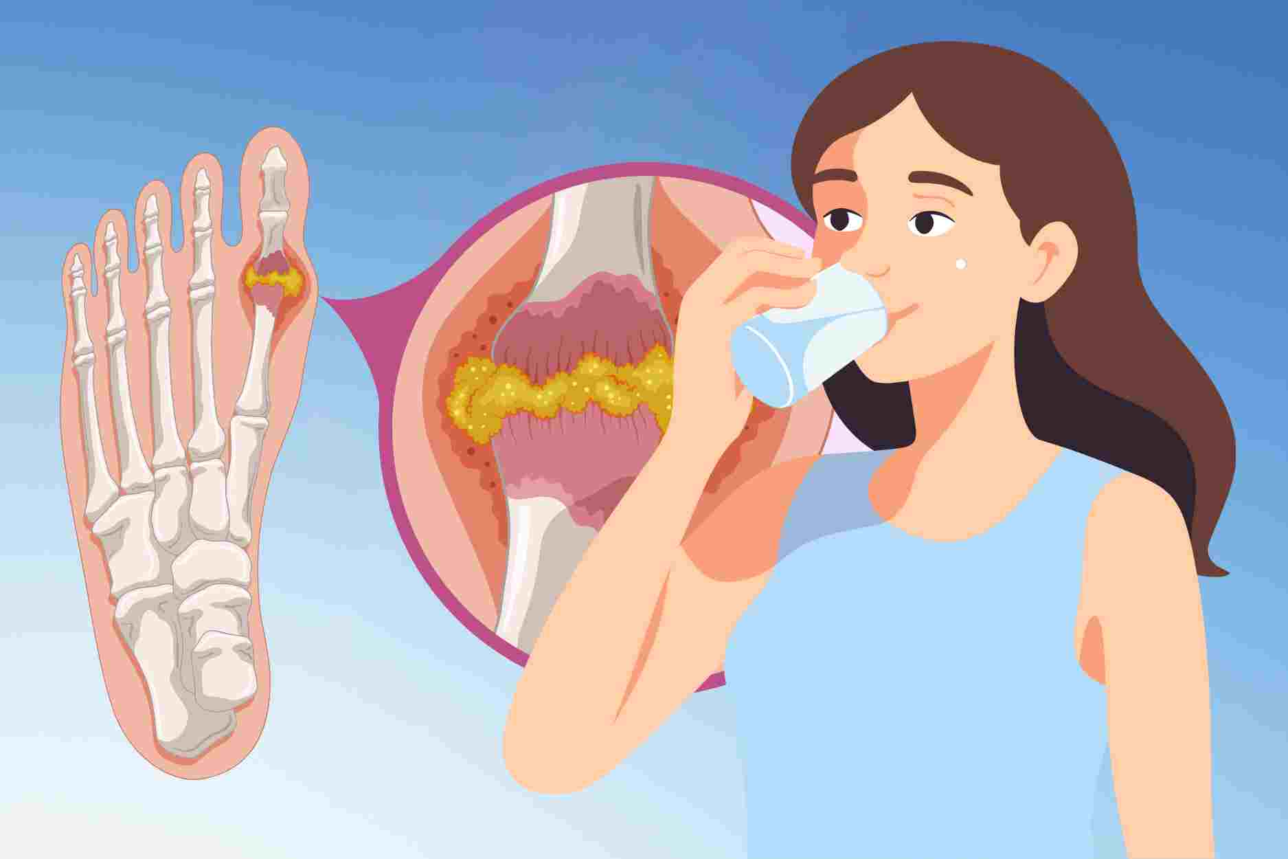 What to drink to help reduce safe uric acid