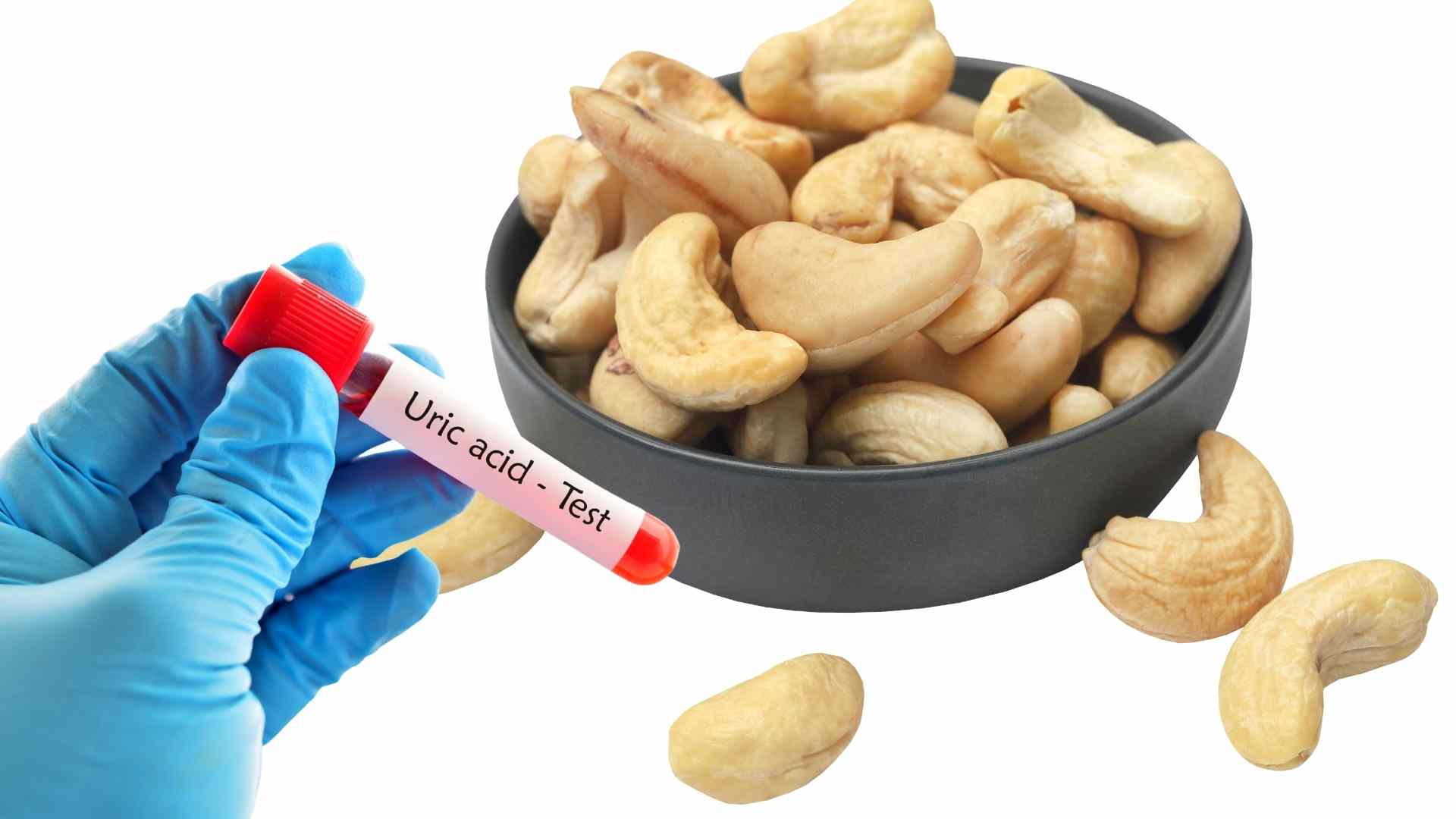 Eating cashews in moderation will not affect uric acid levels. Graphics: Ha May