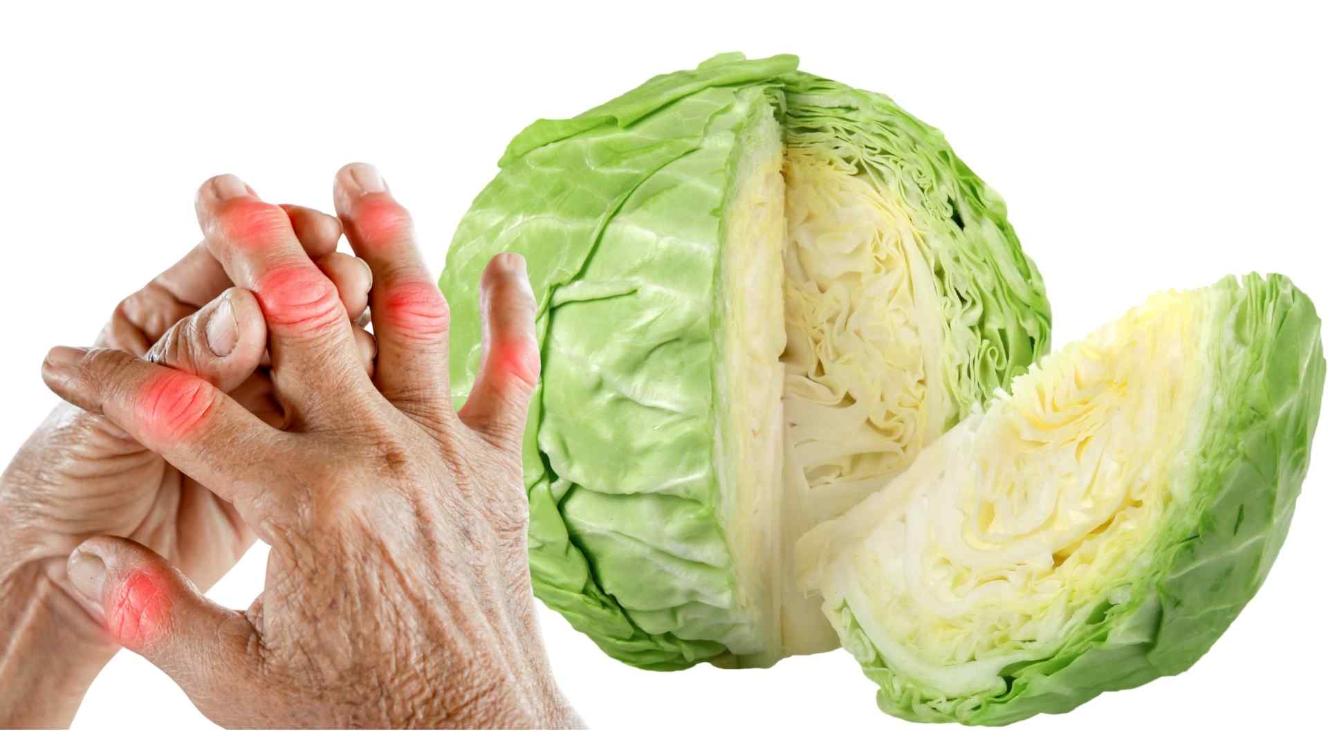 Cabbage can help improve gout. Graphics: Ha May