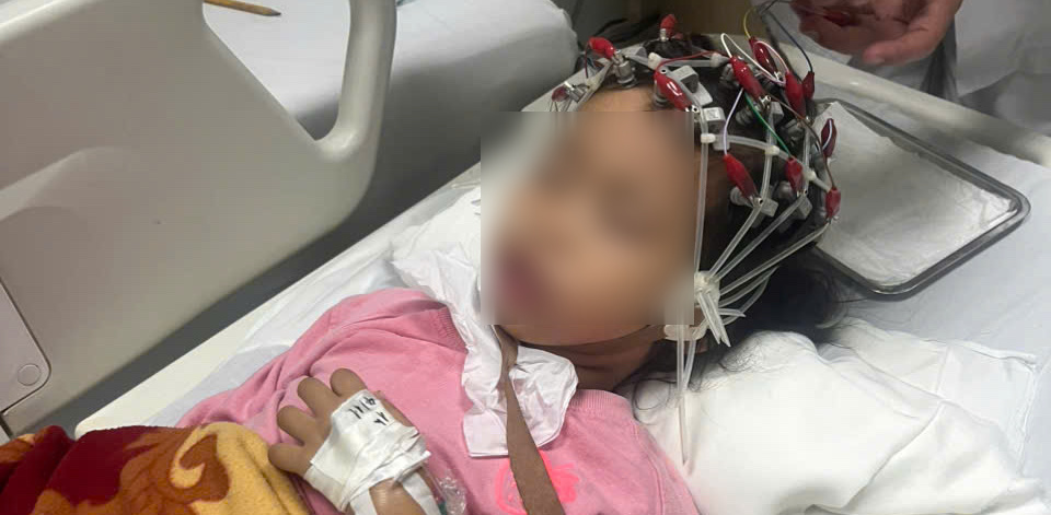 Baby Lan in Hung Yen is lying motionless on a hospital bed, with intricate ligaments. Photo: Provided by family