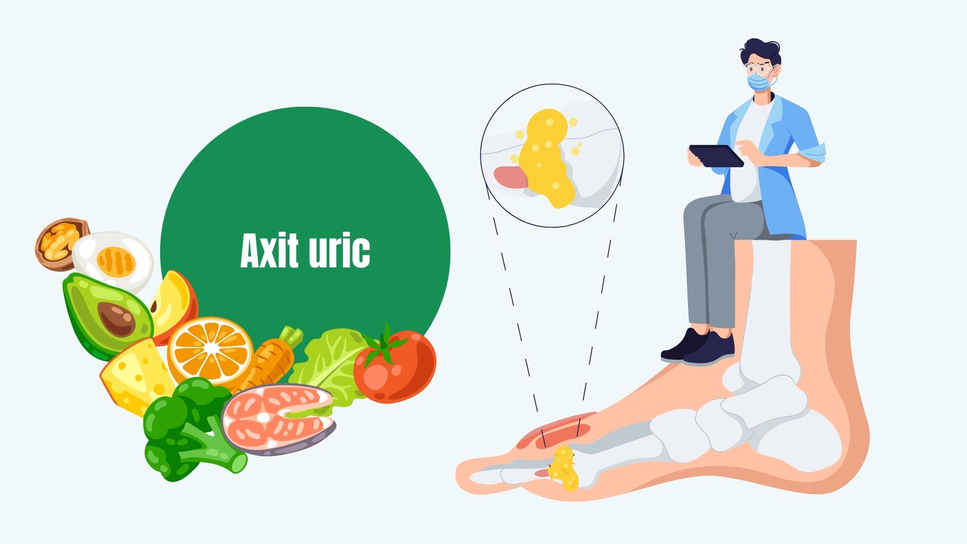 Cheap but extremely effective way to excrete uric acid. Graphics: Linh Dan