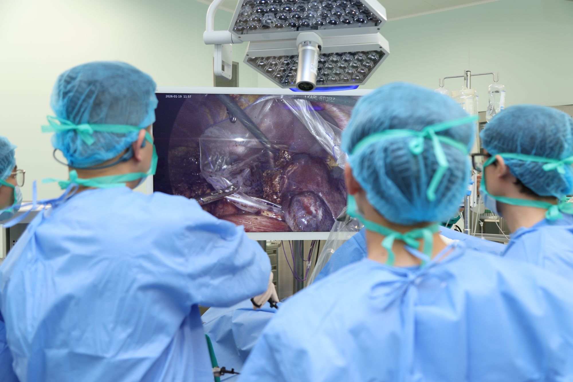 Doctors successfully performed endoscopic surgery on a large left liver hemangioma. Photo: Lan Huong