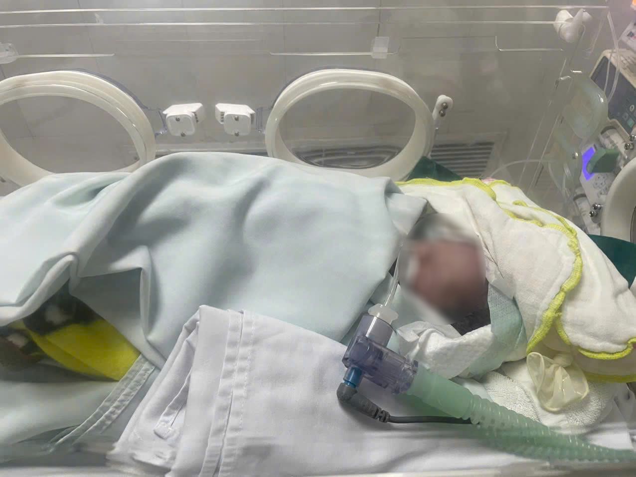 Chau be dang duoc cap cuu, dieu tri tai benh vien, hien suc khoe da qua con nguy kich. Anh: Benh vien cung cap