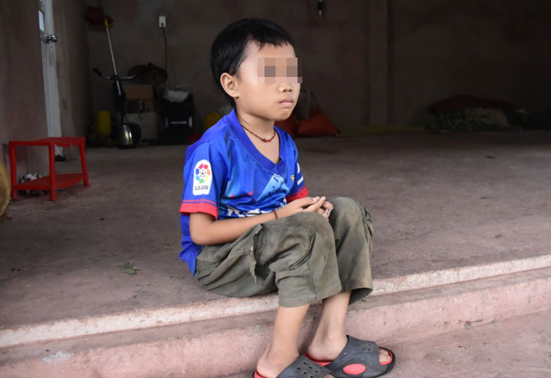 Mac benh tan mau bam sinh - can benh quai ac da khien co the Nhat heo hon, gay mon. Anh: Tung Duong