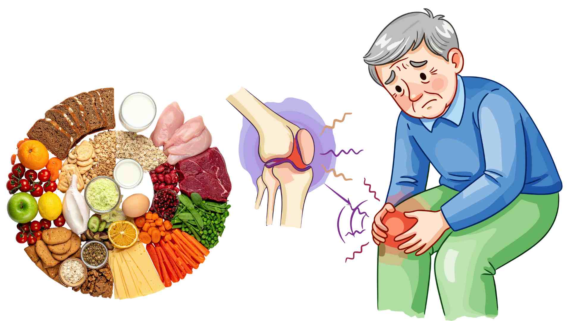 Some foods silently make gout worse. Graphics: Ha May