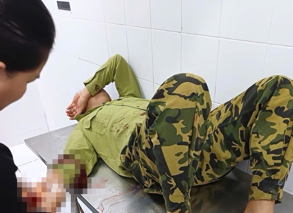 Forest protection workers in Dong Nai were attacked while patrolling in Phu Ly commune, Dong Nai province. Photo: HAC