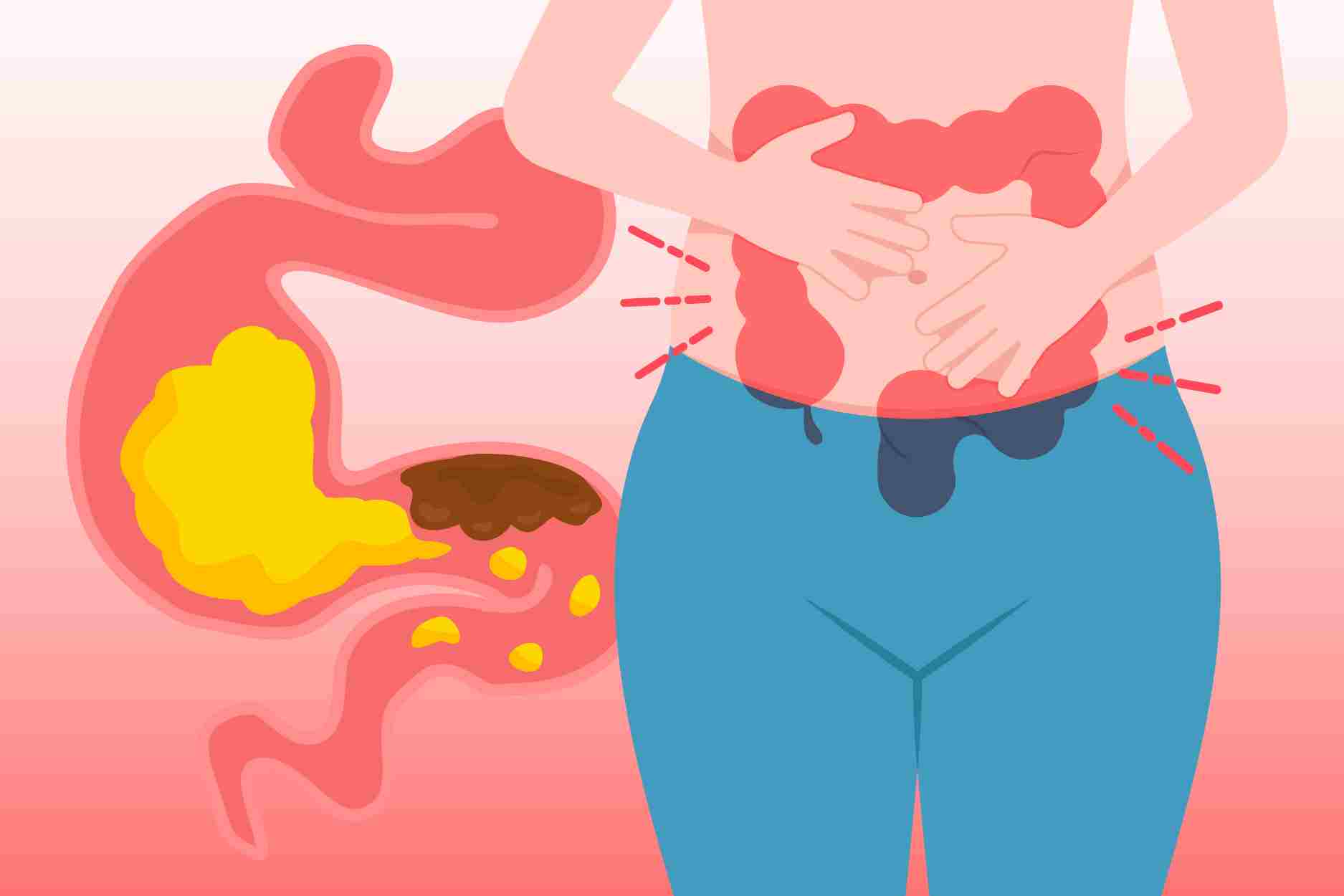 놓치지 말아야 할 장폐색 경고 징후