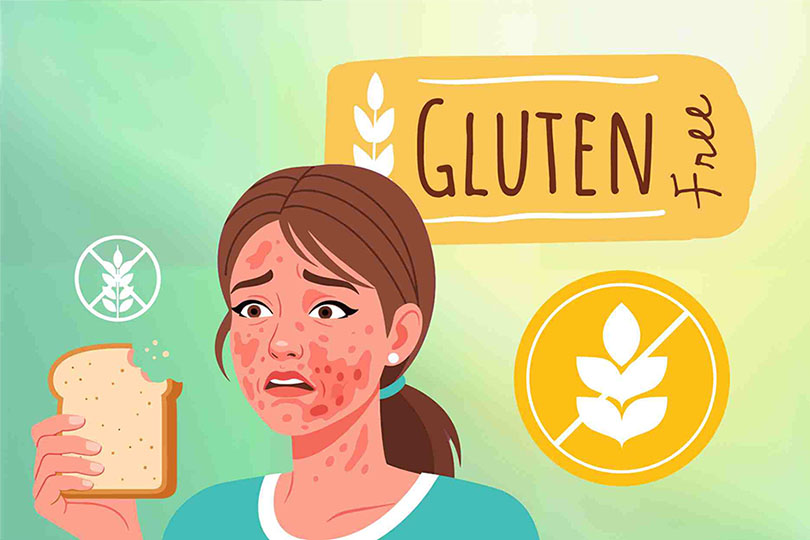 Cardiologist explains why many people become sensitive to gluten. Graphics: Cat Tien