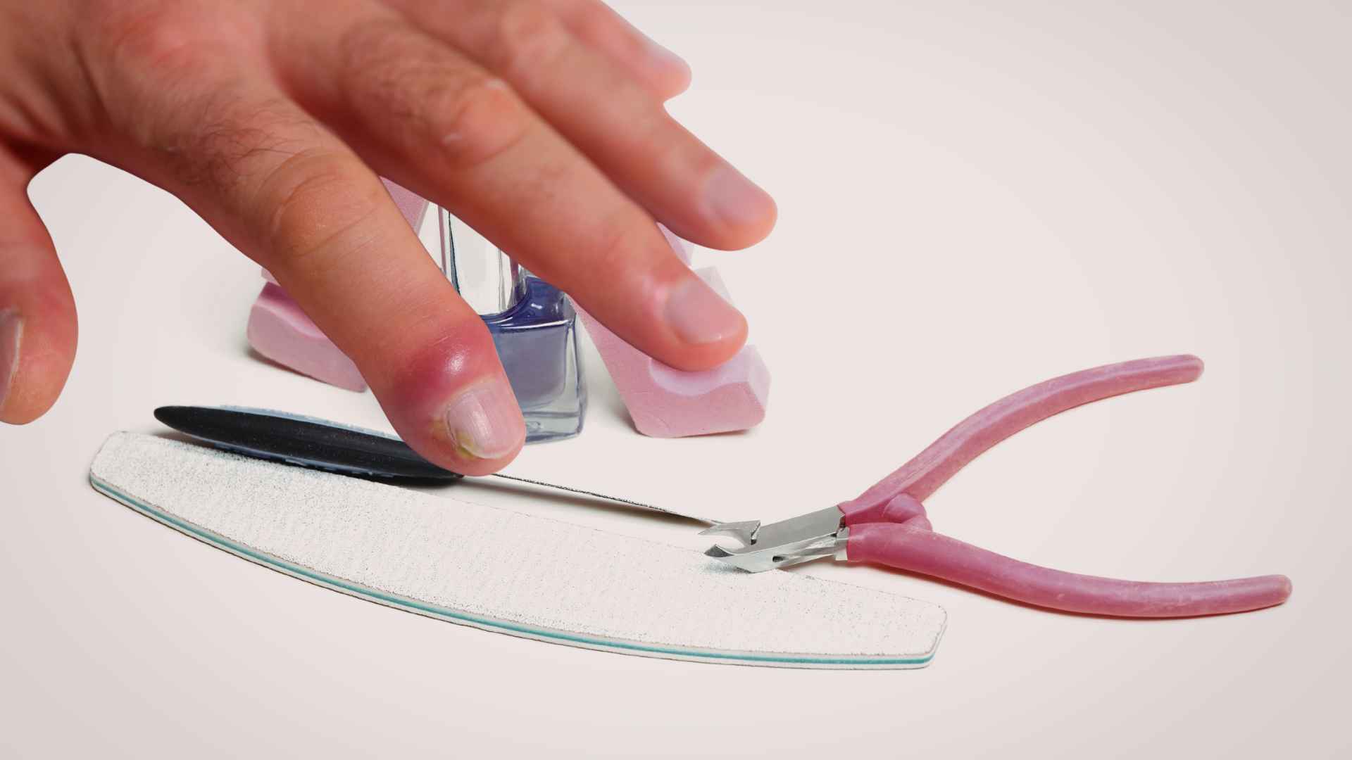 The habit of getting nails often makes many people prone to complications. Graphic photo: Huong Son