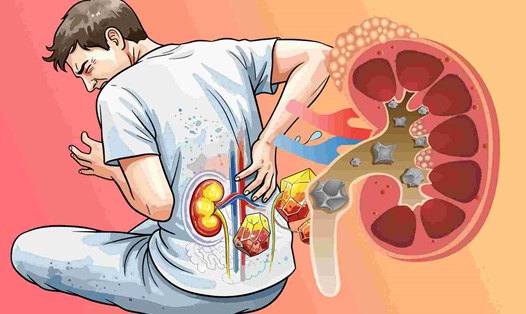 Cách dễ nhất để biết thận đang tốt lên hay xấu đi