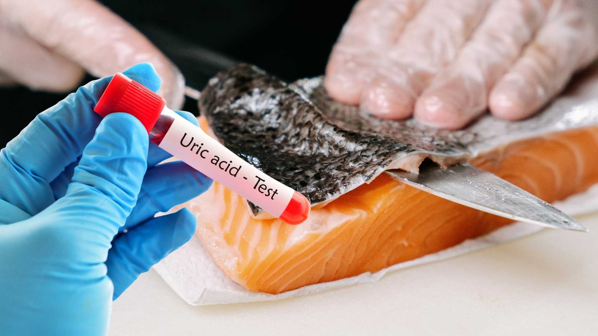 Reasons why people with high uric acid should minimize eating salmon