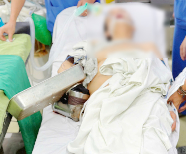 Nguoi dan can thao tac can trong voi may xay thit, tranh de bi tai nan nguy hiem den tinh mang. Anh: Thanh Tuan 