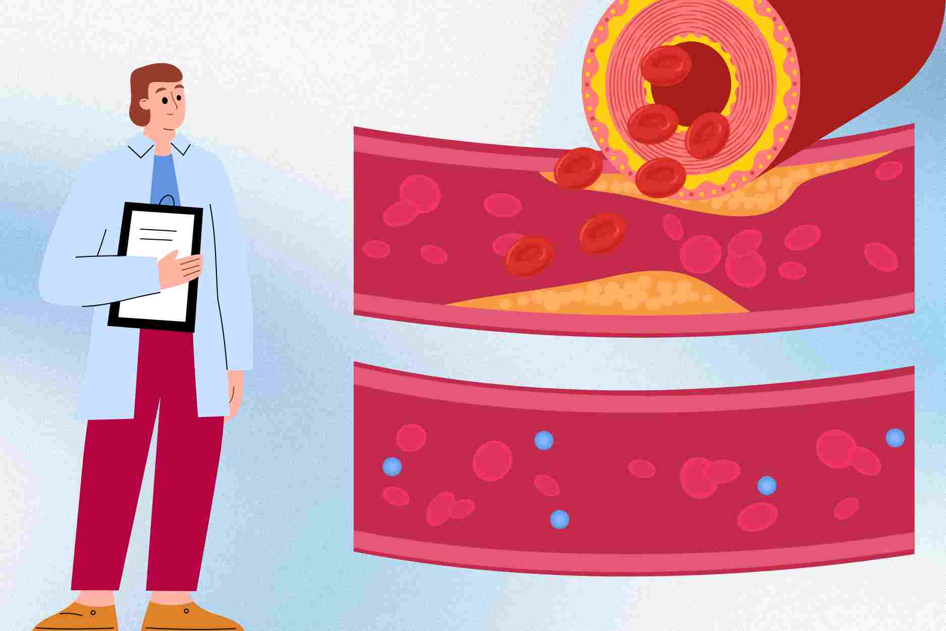 Doctors suggest 5 daily habits to help arteries healthy