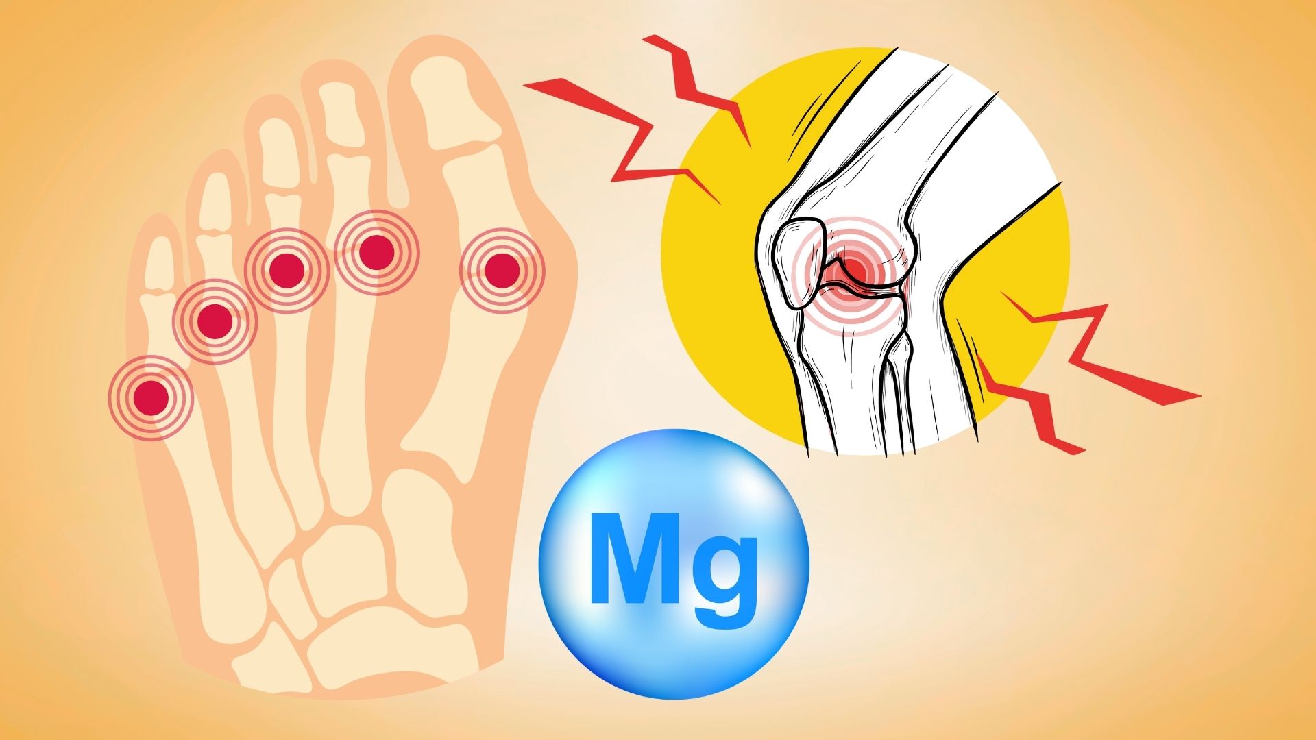 When people with high uric acid need to stop supplementing magnesium