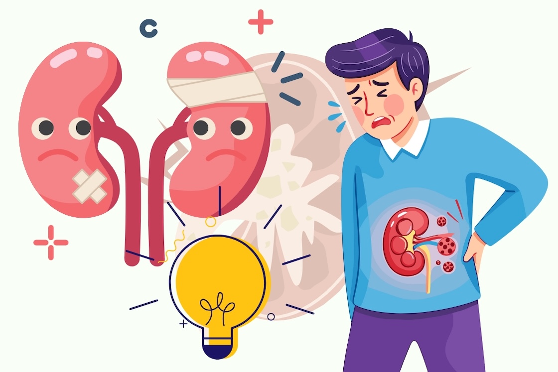 How to know if a kidney is getting better or worse