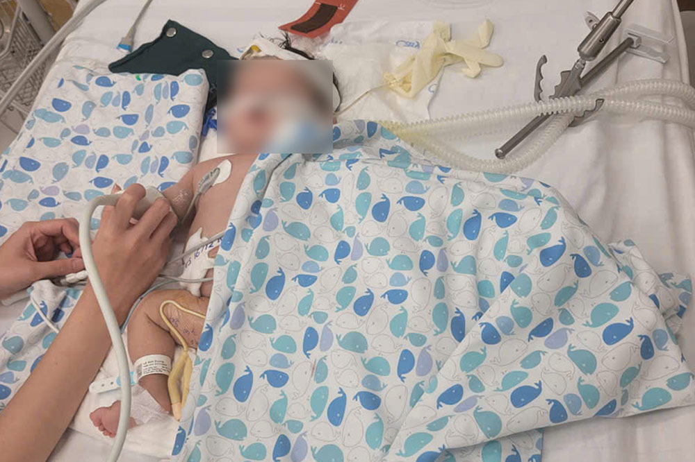 Be Anh Duong nho be nam tren giuong hoi suc voi du loai day chuyen, may moc. Anh: BVCC