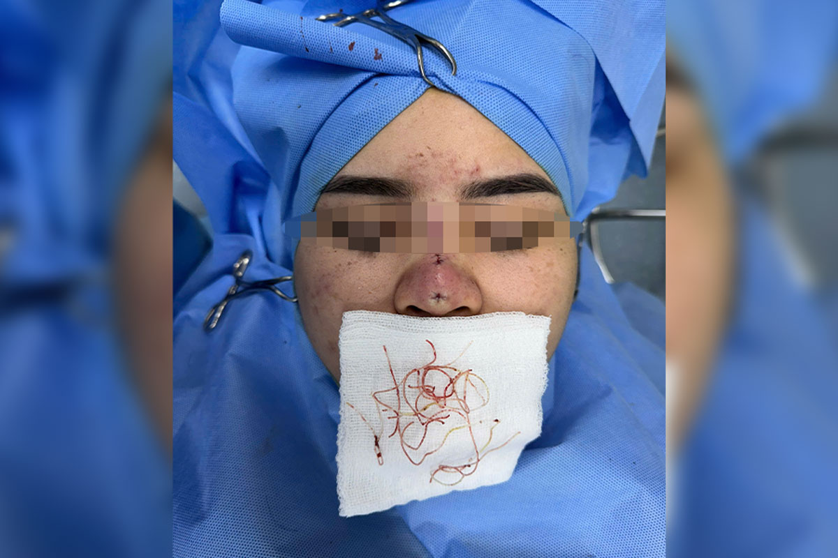 Doctors show safe beauty methods, avoiding rapid aesthetic traps during Tet