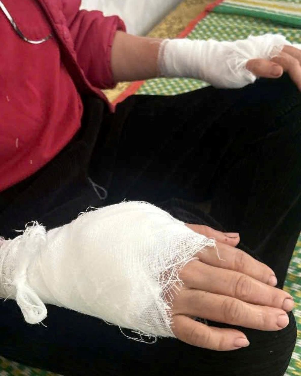 Nguoi phu nu bi con khi tan cong phai khau 15 mui. Anh: Minh Hoang