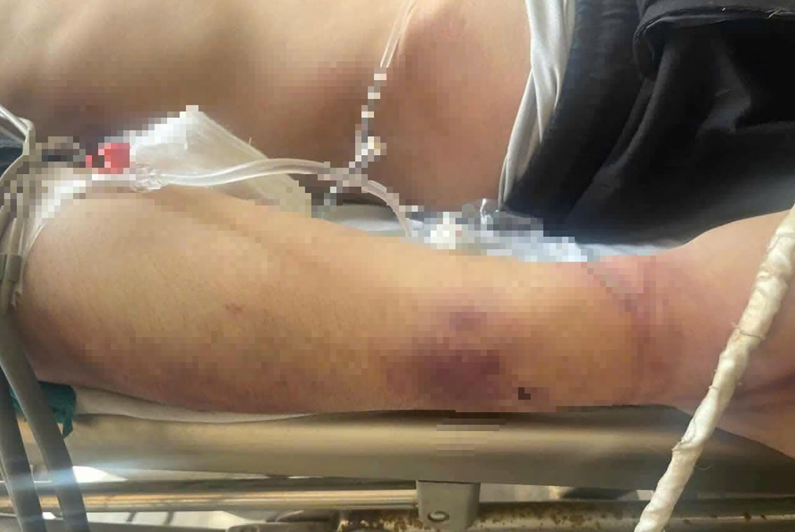 Co the chau Pham Hai Nam chi chit vet tham tim do bi danh. Anh do nguoi nha cung cap