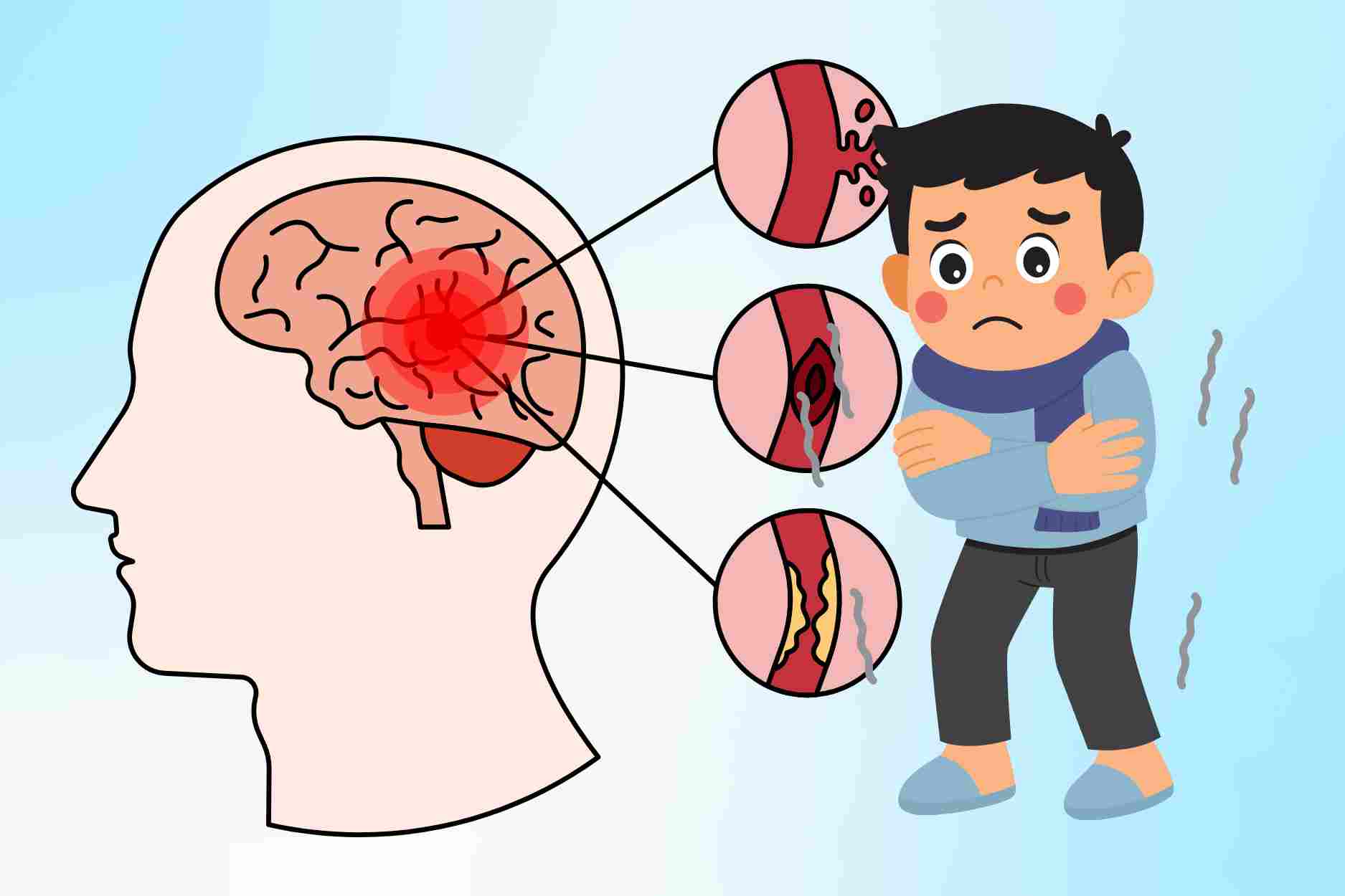 3 cold weather times that easily trigger stroke many people do not know