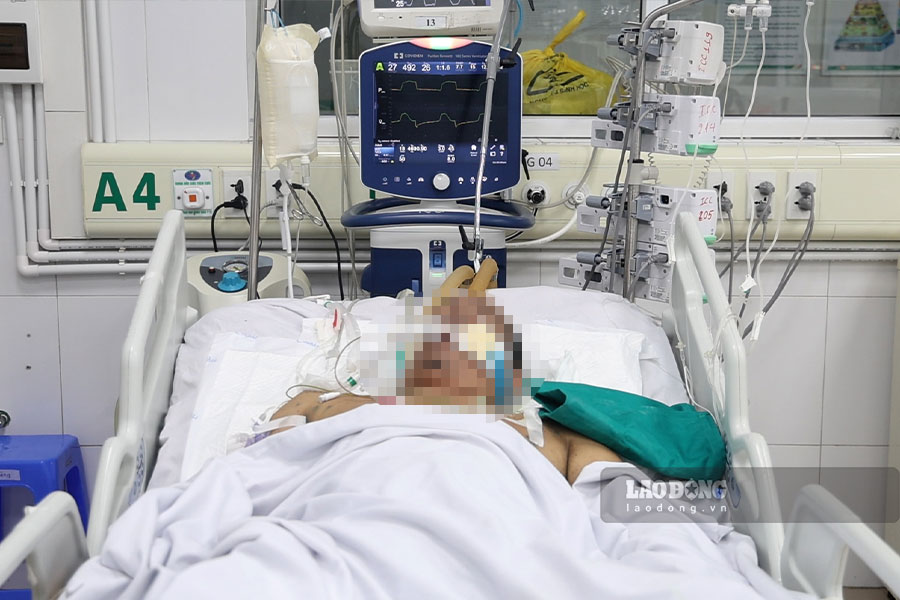 Infected with chickenpox from a child, a man had to use a ventilator and suffered from pneumonia complications