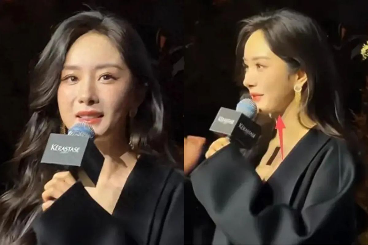 Duong Mich's face was swollen and stiff. Photo: cut from video