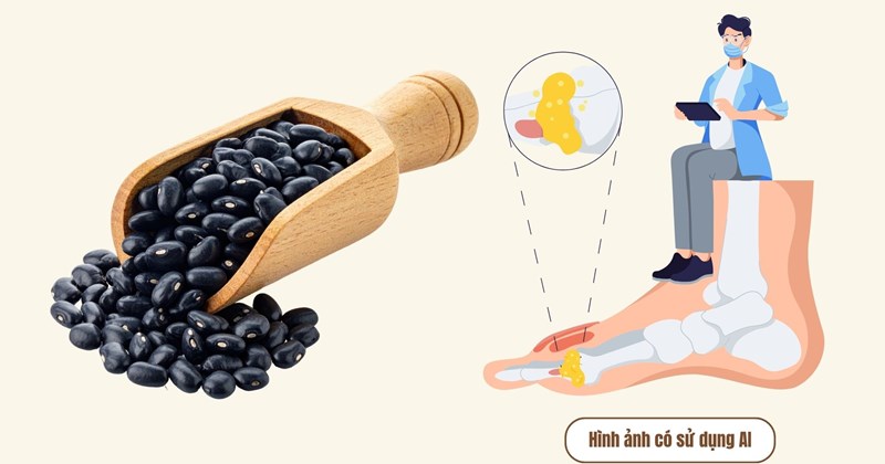 Lower Support Car Familiar seeds that help lower uric acid