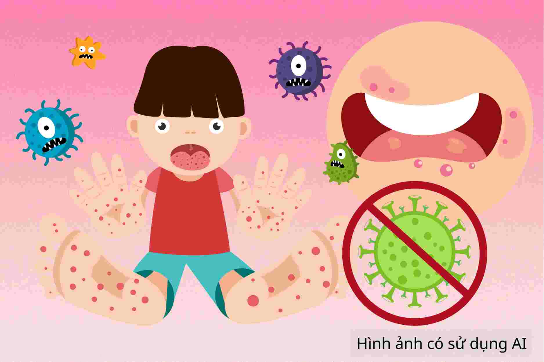 Hand, foot and mouth disease and notes on vaccination after recovery