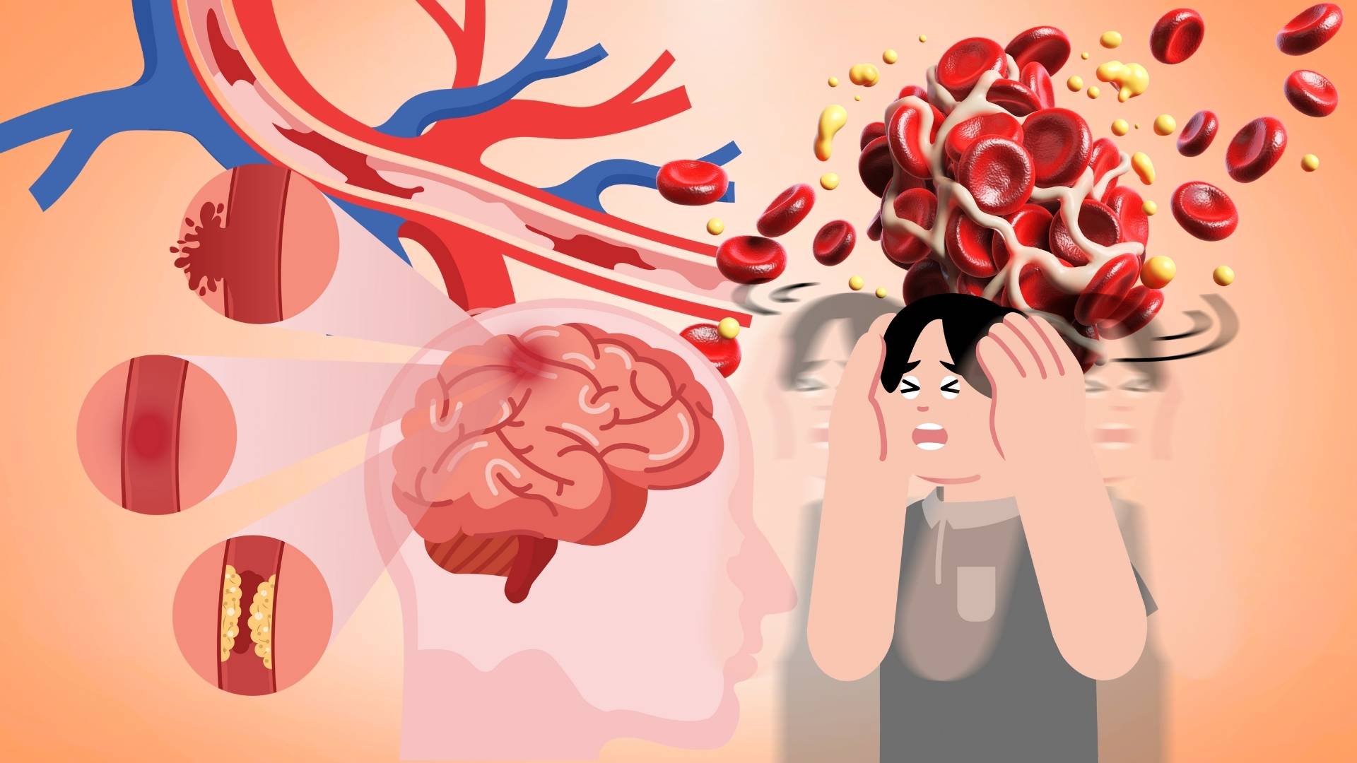 Signs of blood clots forming