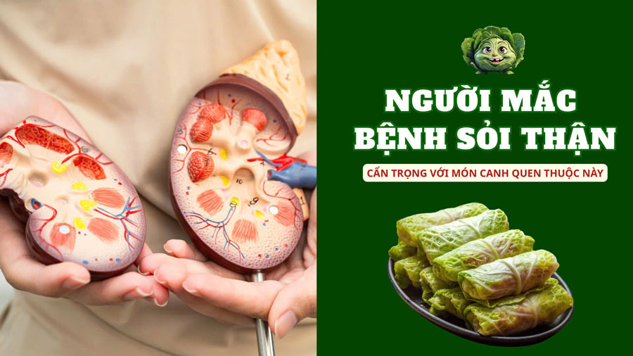 People with kidney stones should be careful with this familiar soup