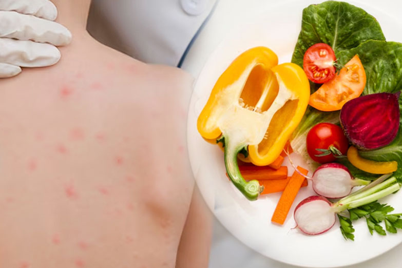 Vegetables that help increase resistance and support chickenpox prevention. Graphics: Thien Nhan