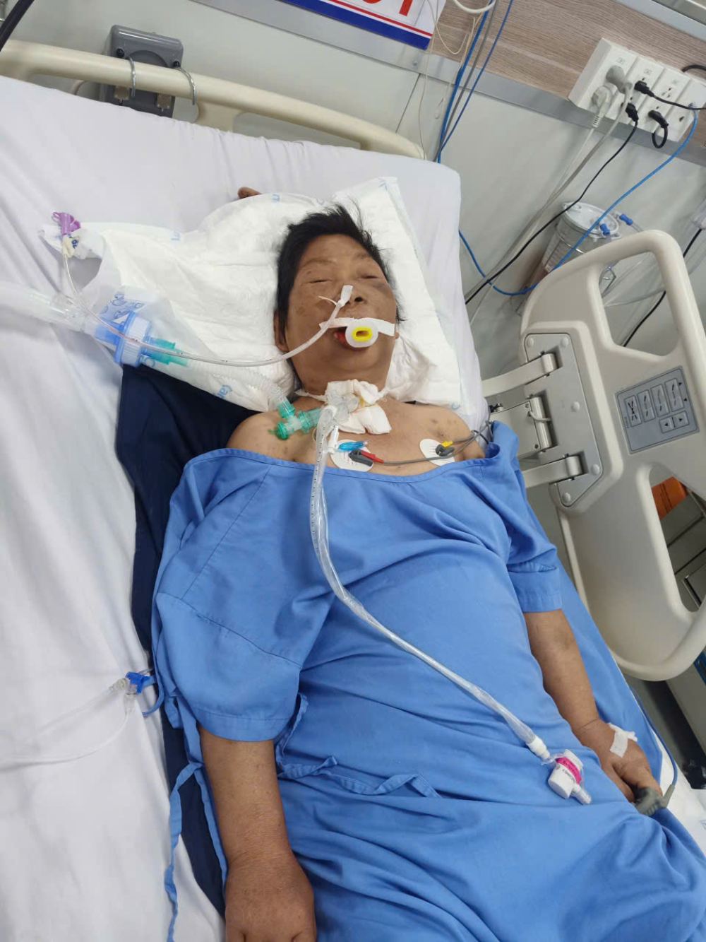 Hiện nay, bà Kim Anh đang điều trị cấp cứu tại Bệnh viện Đại học Y Hà Nội. Ảnh: NVCC