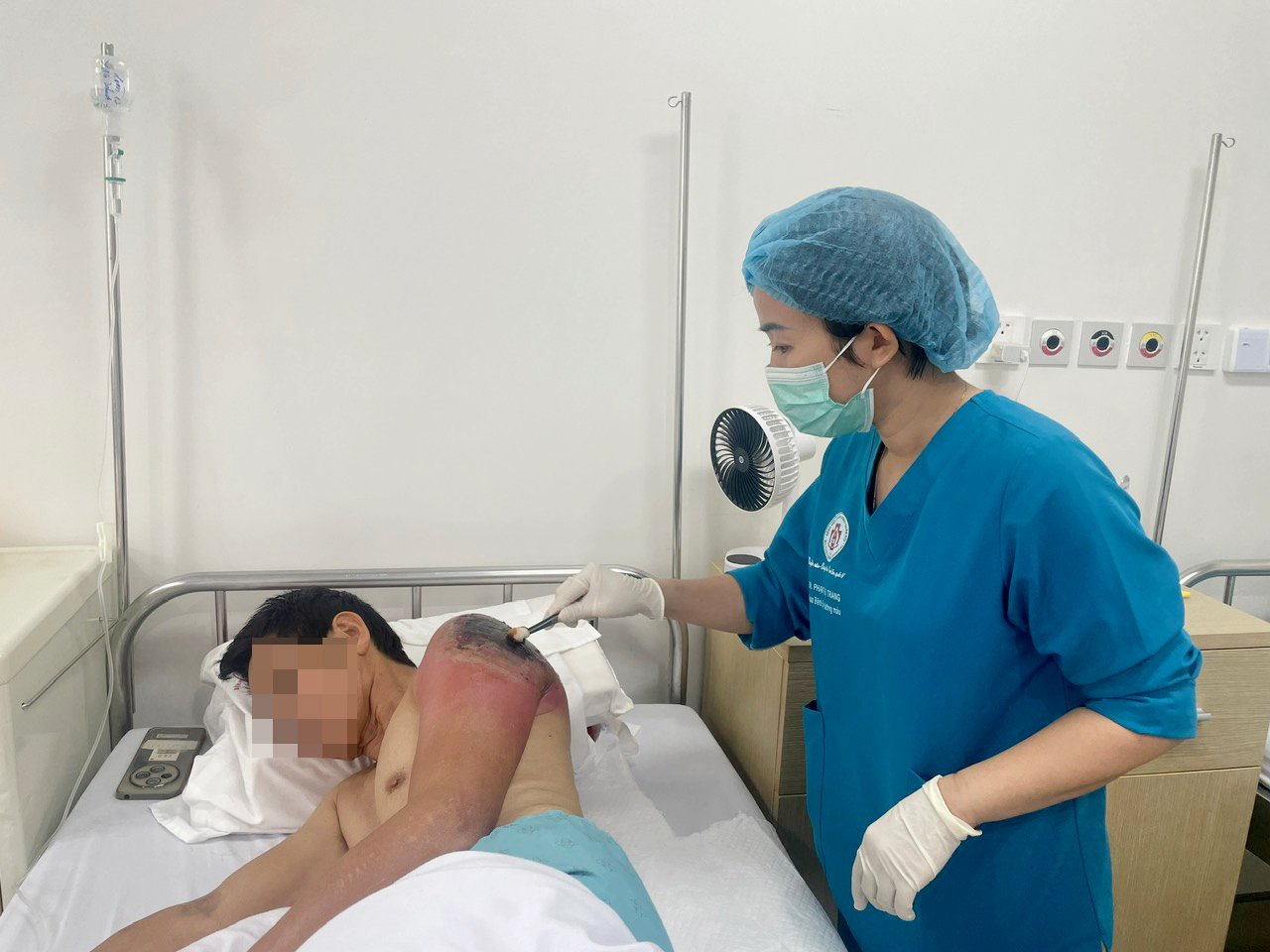 Applying leaves to treat injuries, almost losing an arm due to folk remedies. Photo: BVCC